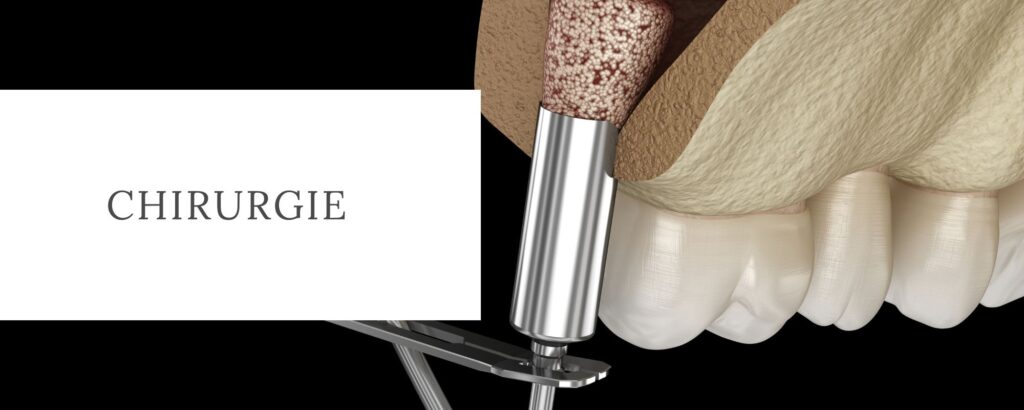 chirurgie Cabinet Dentaire de la Lone - dentiste - Boulbon