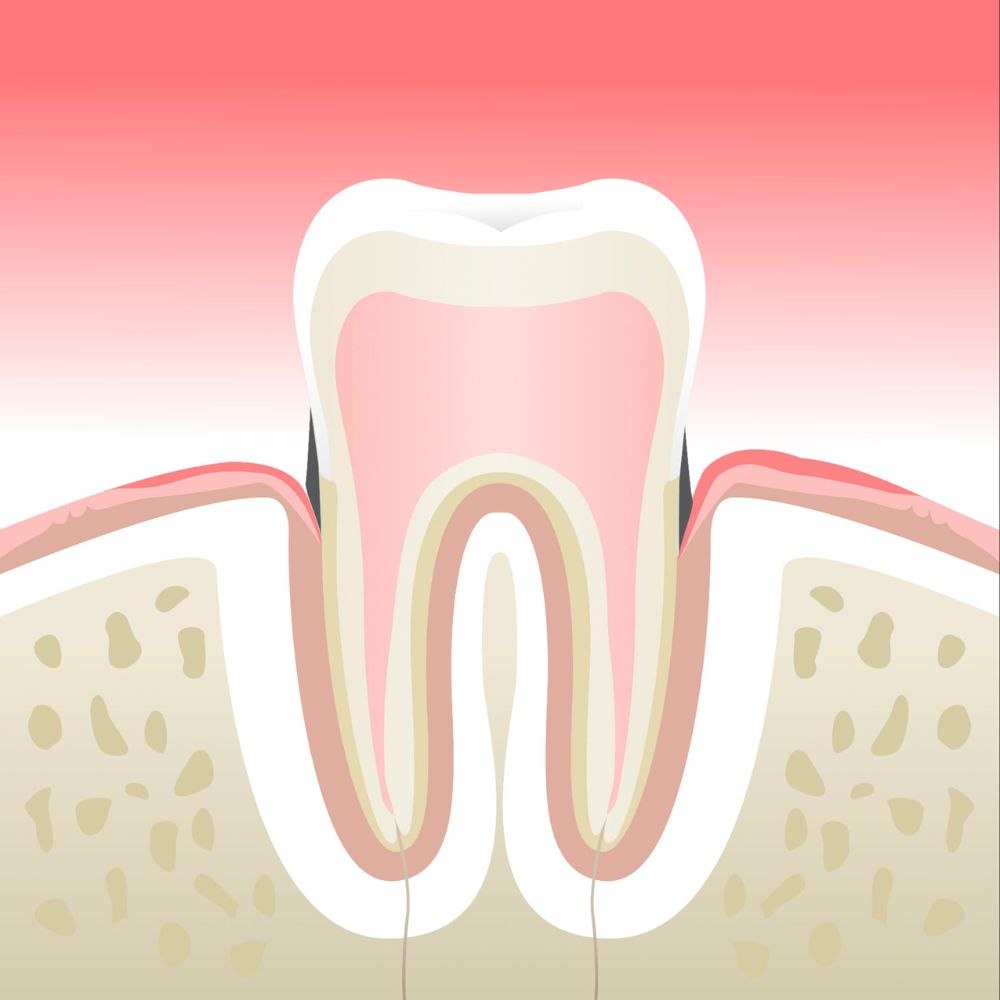 Parodontologie Cabinet Dentaire de la Lone - dentiste - Boulbon