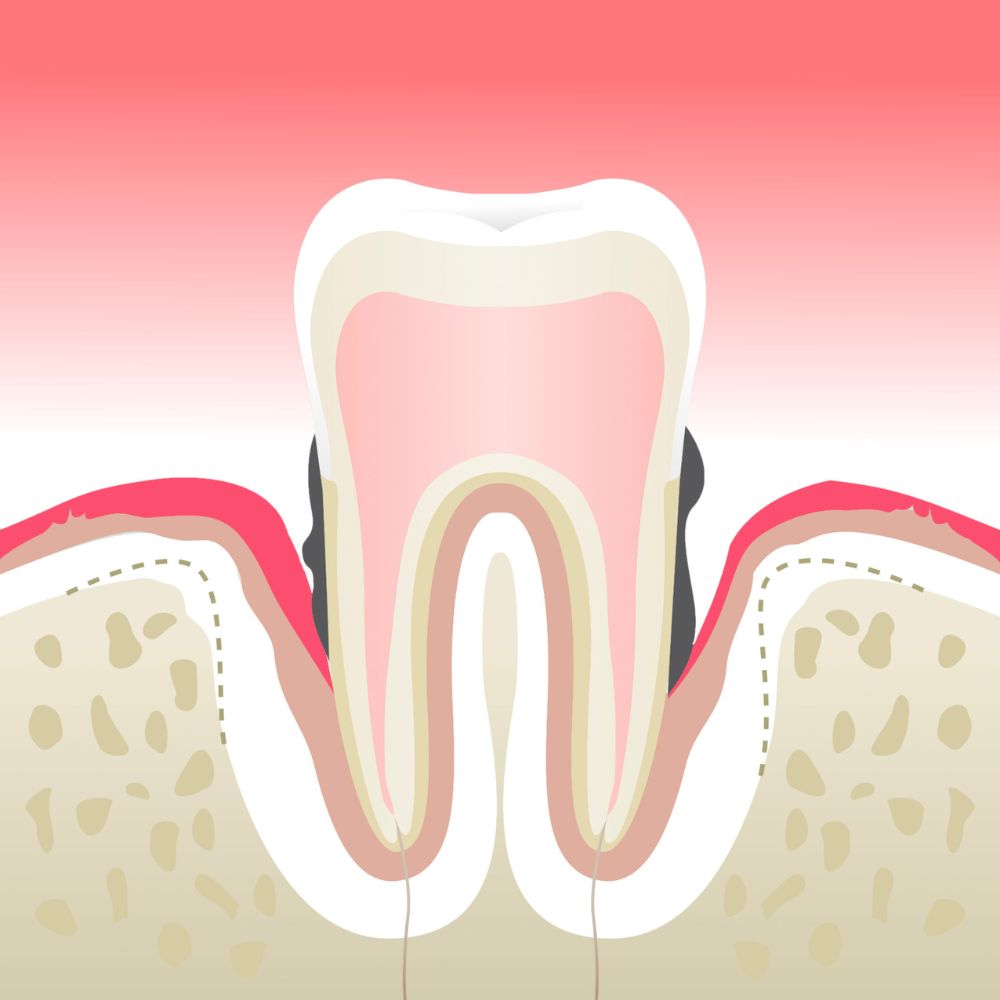 Parodontologie Cabinet Dentaire de la Lone - dentiste - Boulbon
